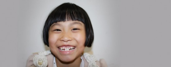 オペレーション・ブレッシングは中国の8歳の少女に口蓋裂の無料手術を行いました。